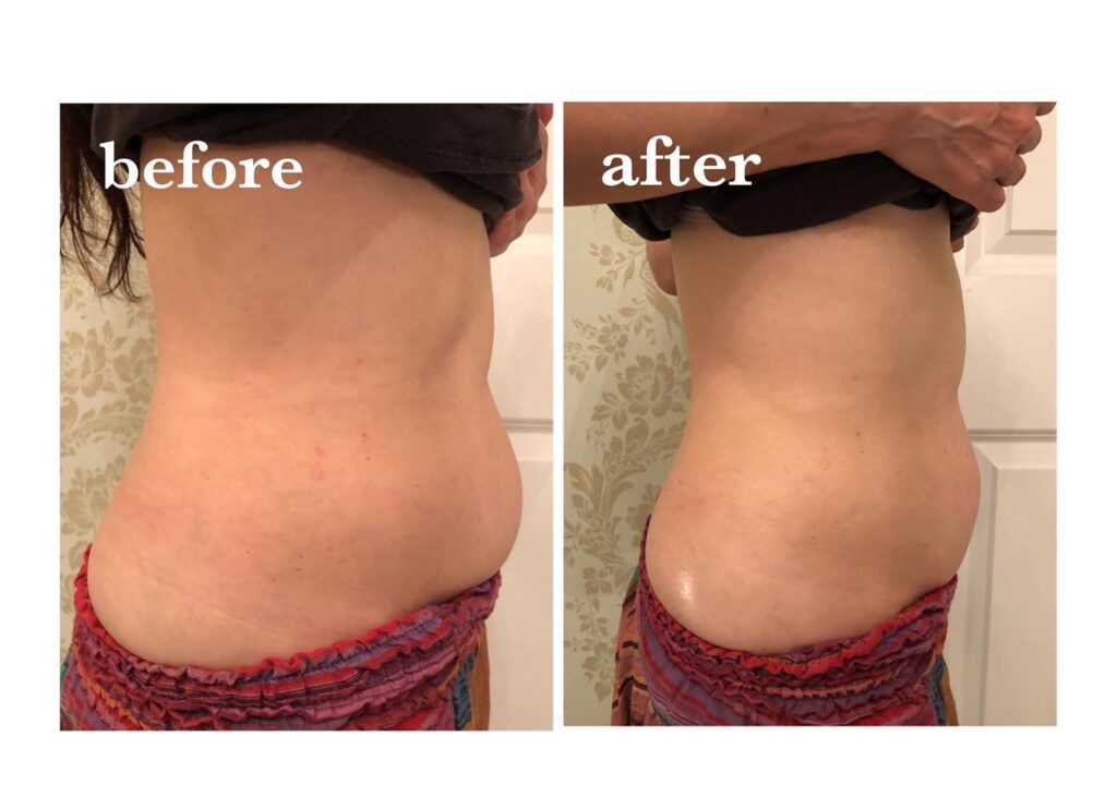 美内臓セラピー|岩倉市美容室【フェアリーズルーム】fairy’sroom