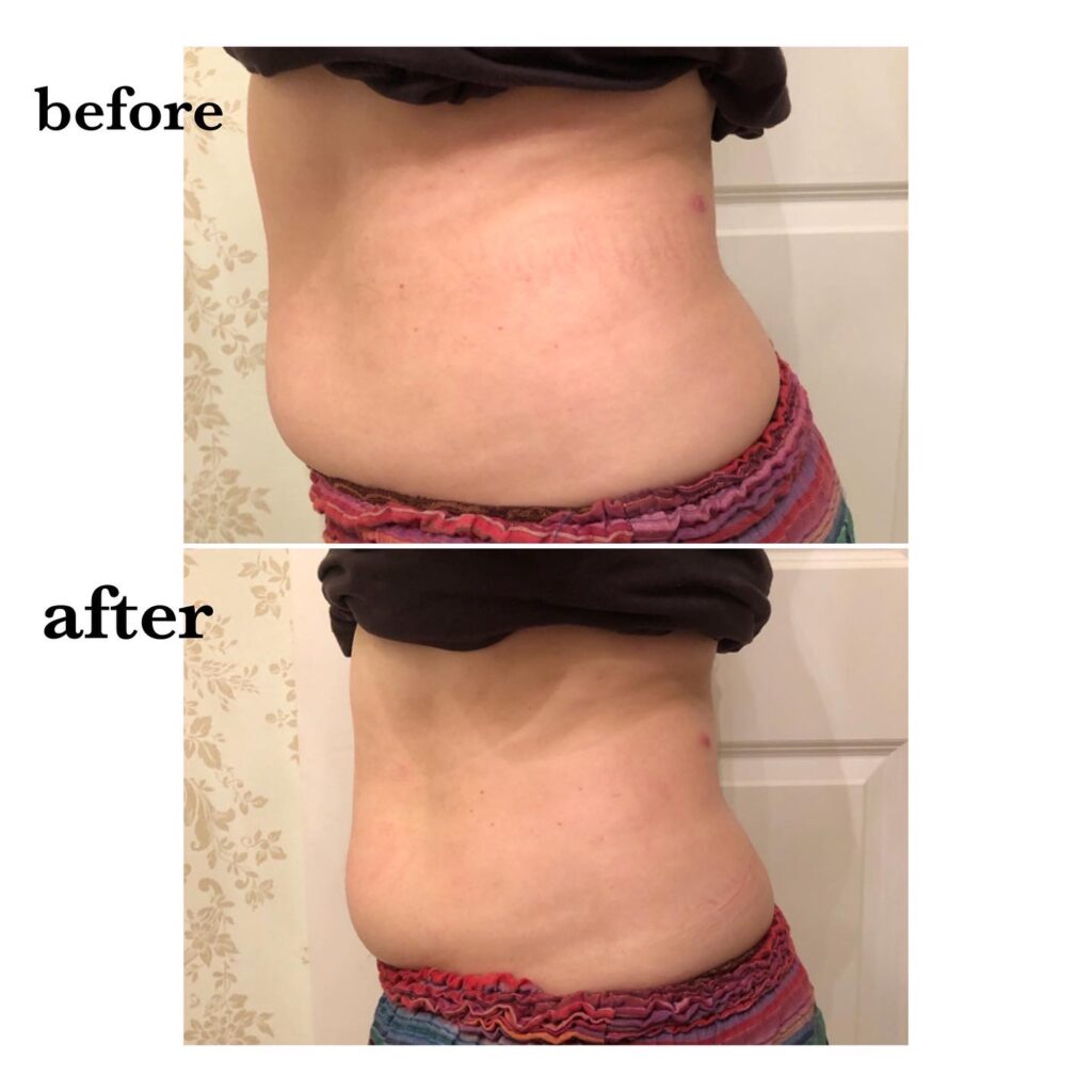 痩身ボディー美内臓セラピー|岩倉市美容室【フェアリーズルーム】fairy’sroom